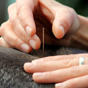 Placing acupuncture needle